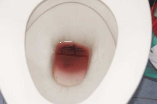 Erkeklerde uyarıldığında lekelenme